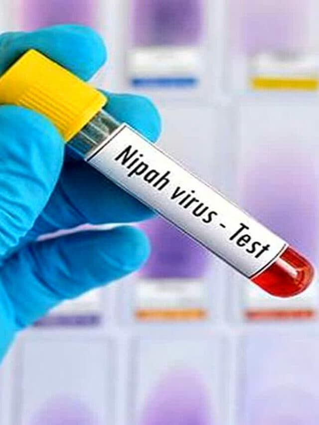 Nipah virus symptoms: निपाह वायरस के लक्षण