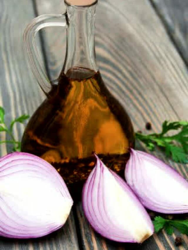Dandruff से छुटकारा पाने के लिए लगाए onion oil.. जानें फायदे