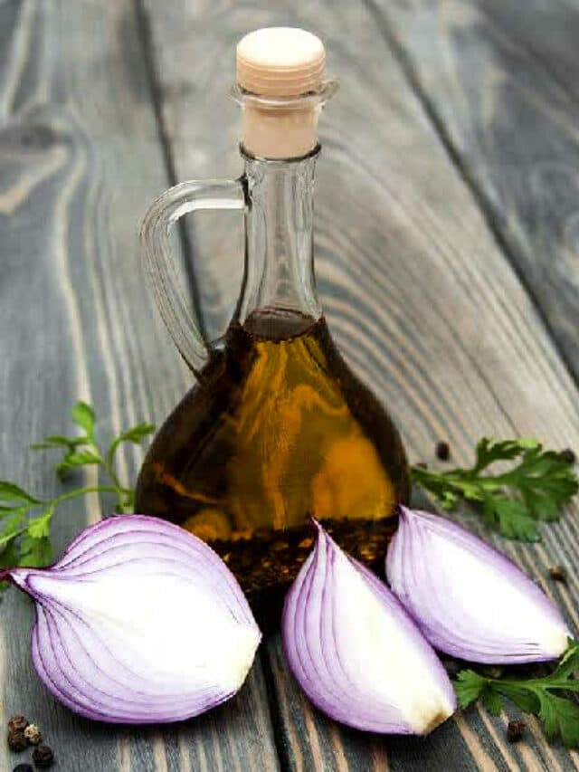 Onion Oil for Dandruff: सर्दियों में डैंड्रफ से छुटकारा पाने के लिए लगाए ये तेल