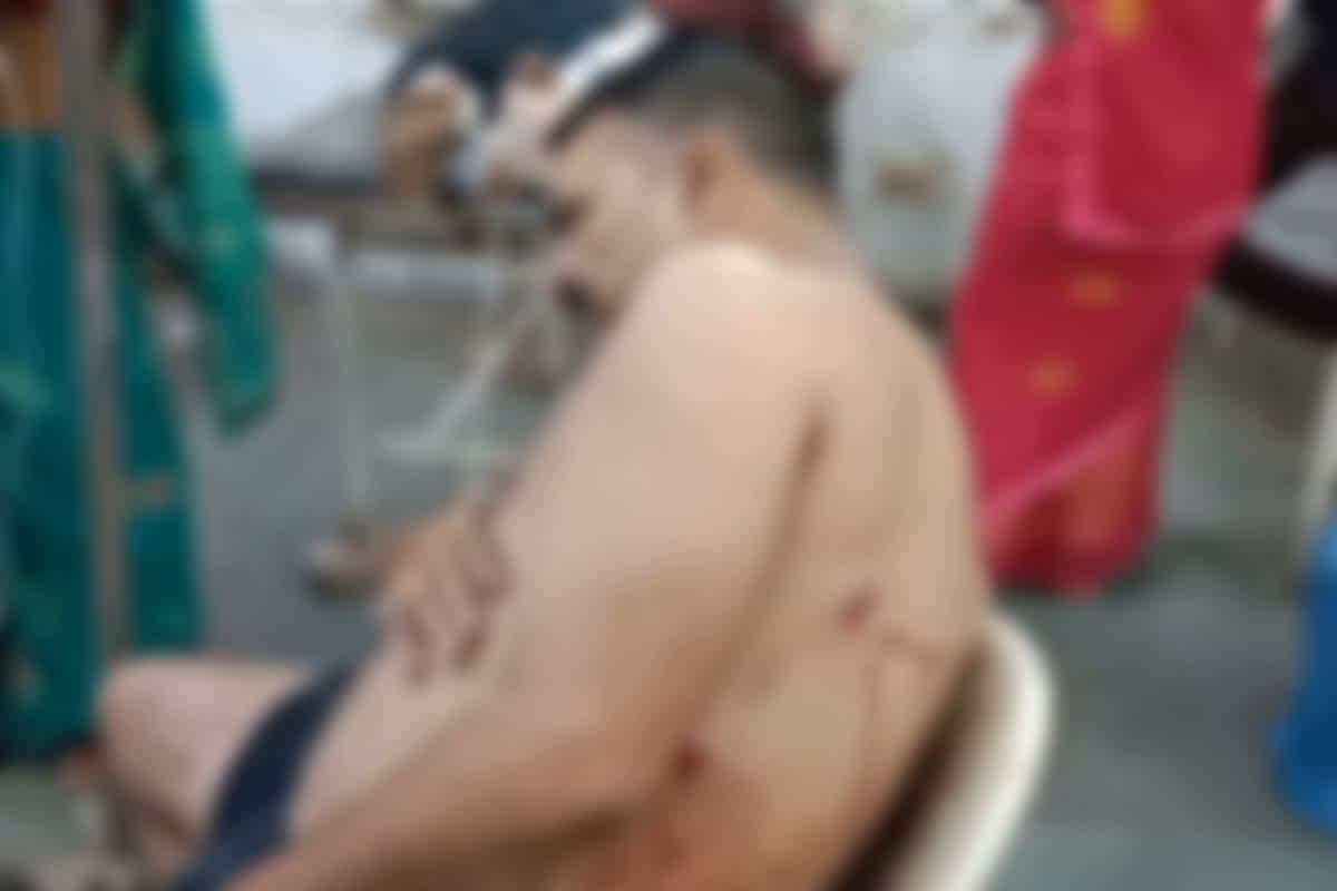 Gwalior Firing News: दिनदहाड़े दो सगे भाईयों पर दर्जनों बदमाशों ने की ताबड़तोड़ फायरिंग, घायल अवस्था में पहुंचे अस्पताल, इलाके में मचा हड़कंप