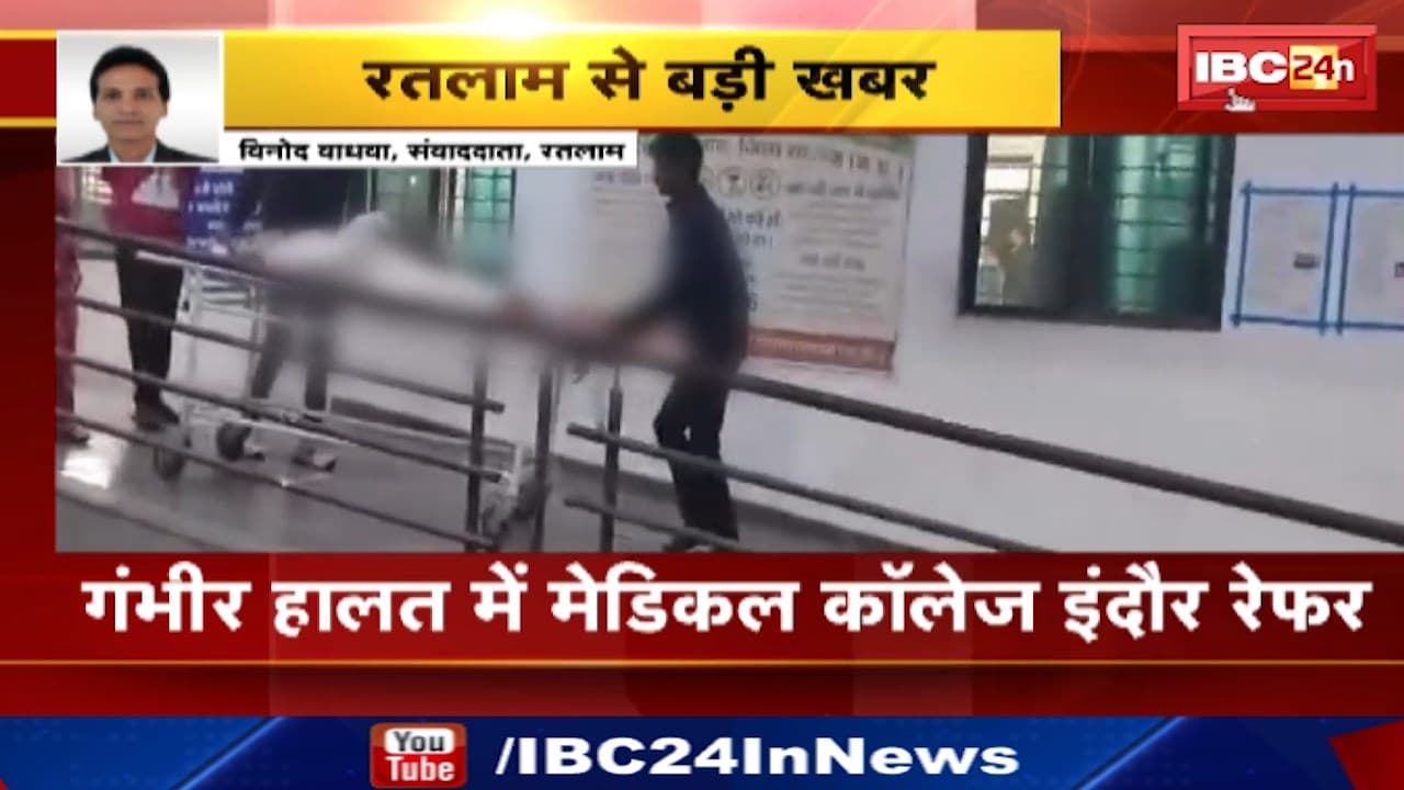 Ratlam News : जमानत पर बाहर आए आरोपी ने खुद को लगाई आग | गंभीर हालत में Medical College Indore Refer