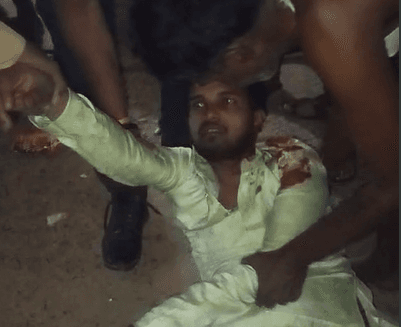 Shivpuri News: बर्थडे पार्टी के दौरान इस बात पर हुआ विवाद, युवक ने दांतों से काट दिया दोस्त के शरीर का ये अंग, लहूलुहान हालत में पहुंचा अस्पताल
