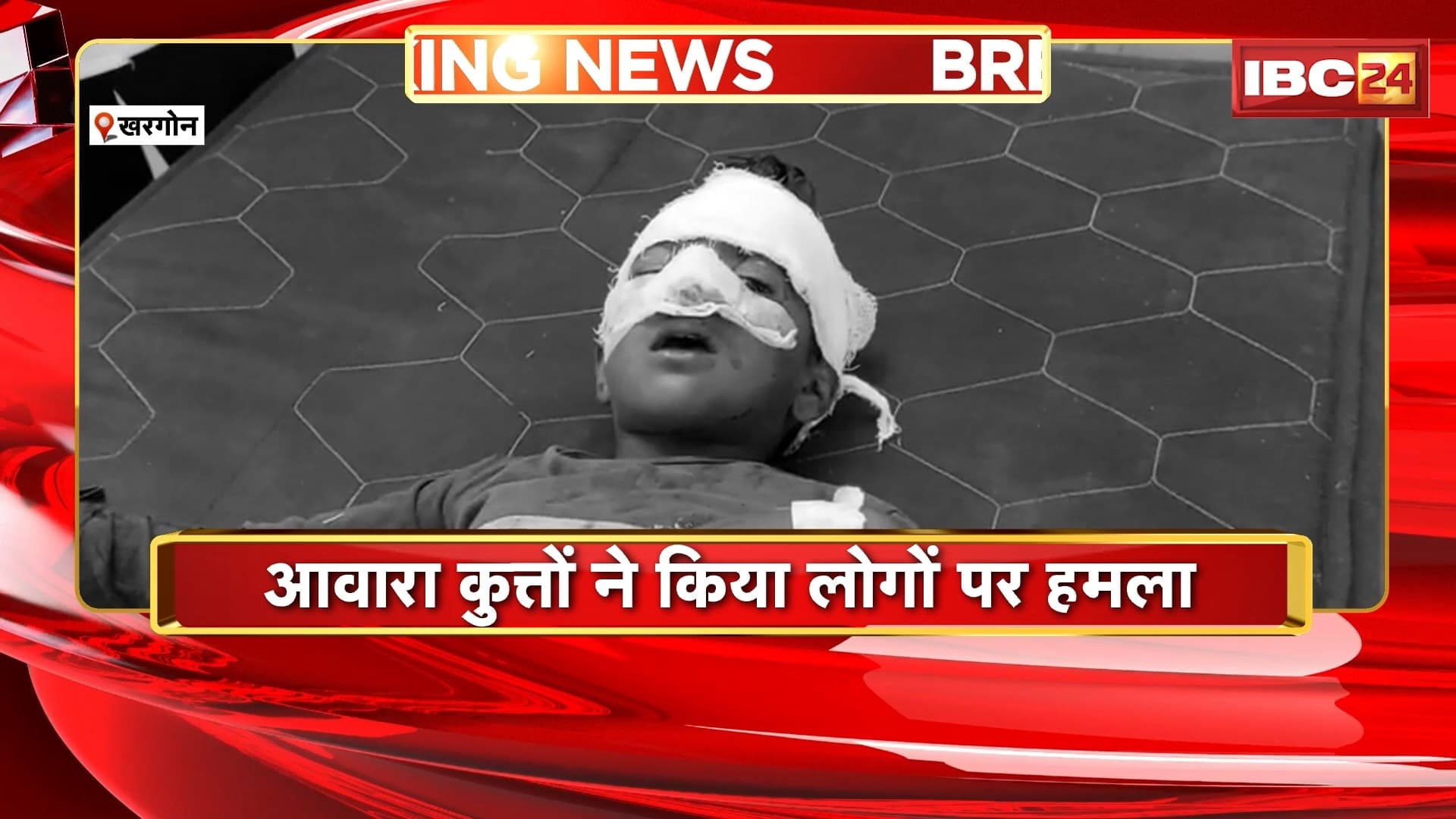 Khargone Dog Bite News: आवारा कुत्तों ने किया लोगों पर हमला। हमले में 12 लोग घायल, घायलों में 8 बच्चे भी शामिल..