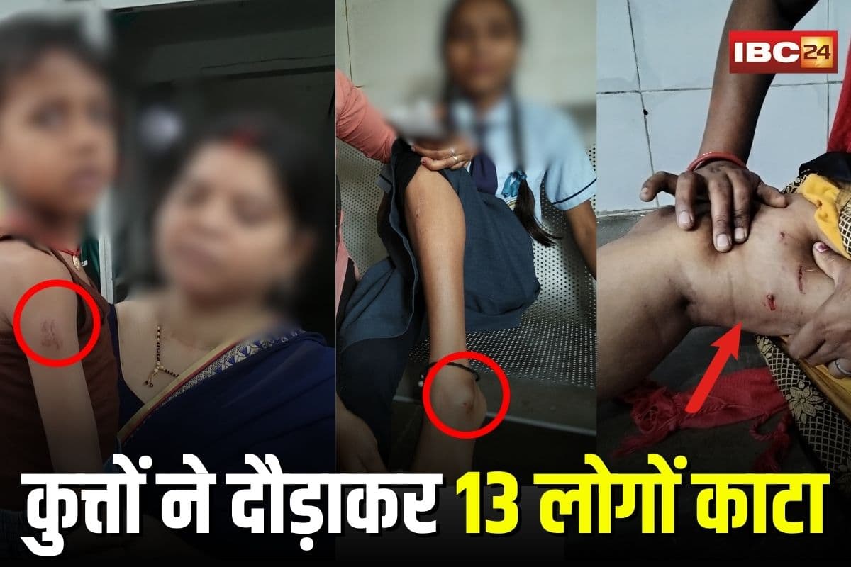Dog Bite News: सड़क पर दौड़ाकर 13 लोगों काटा, बच्चों तक को नहीं छोड़ा, शहर में ऐसे मचाया आवारा कुत्तों ने आतंक