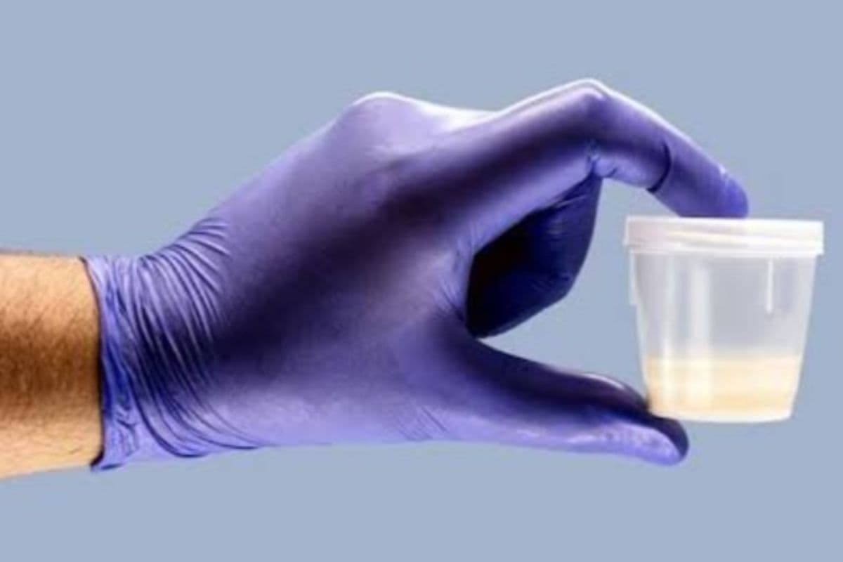 Sperm Smuggling: पुरुषों के वीर्य की तस्करी करती थी ये महिला डॉक्टर, मां बनने के बाद कपल ने कराया डीएनए टेस्ट, हुआ सनसनीखेज खुलासा