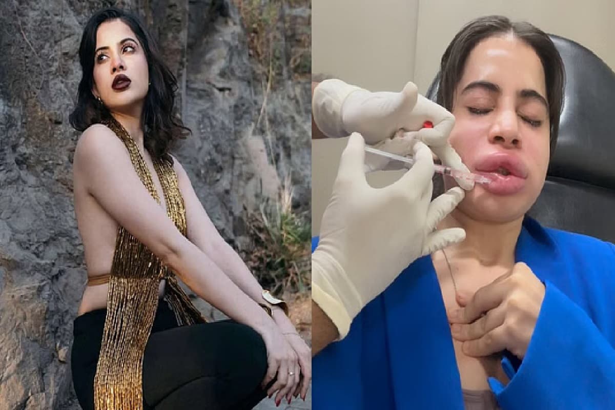 Urfi Javed New Viral Video: उर्फी जावेद ने कर लिया अपना ऐसा हाल, सूजे होंठ-चेहरे को देख हर कोई हुआ हैरान, वायरल हो रहा वीडियो