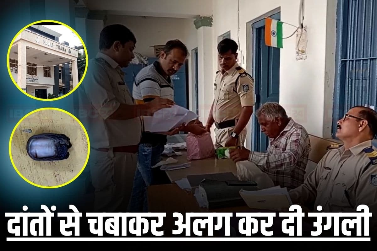 Gwalior News: कटी हुई उंगली लेकर थाने पहुंचा था मजदूर, साथी ने ही दांतों से चबाकर कर दी थी अलग, वजह जानकर पुलिस भी रह गई हैरान