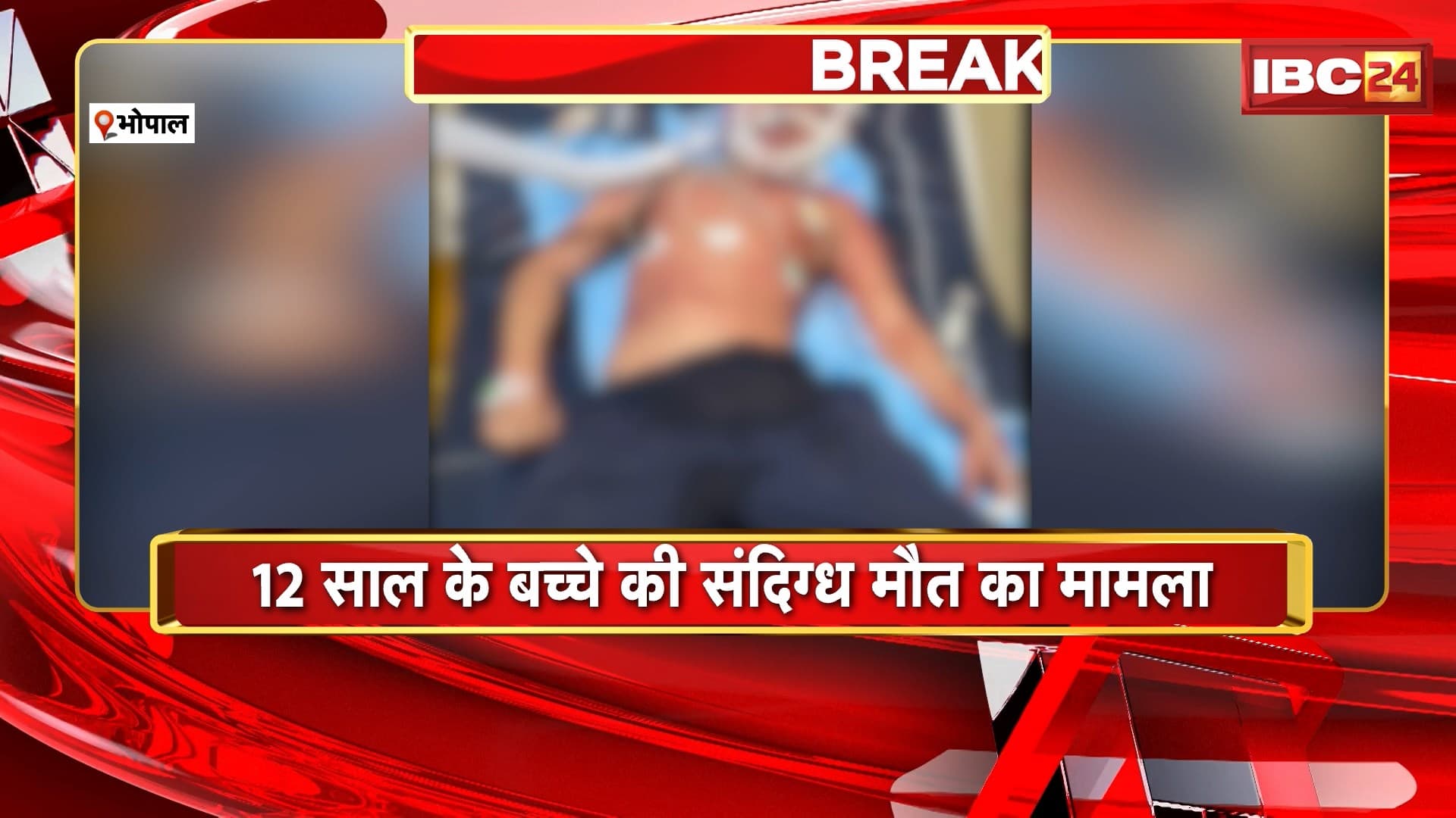Bhopal News : 12 साल के बच्चे की संदिग्ध मौत का मामला | पिस्टल खामरा गिरोह के डीलर के फरार होने की पुष्टि
