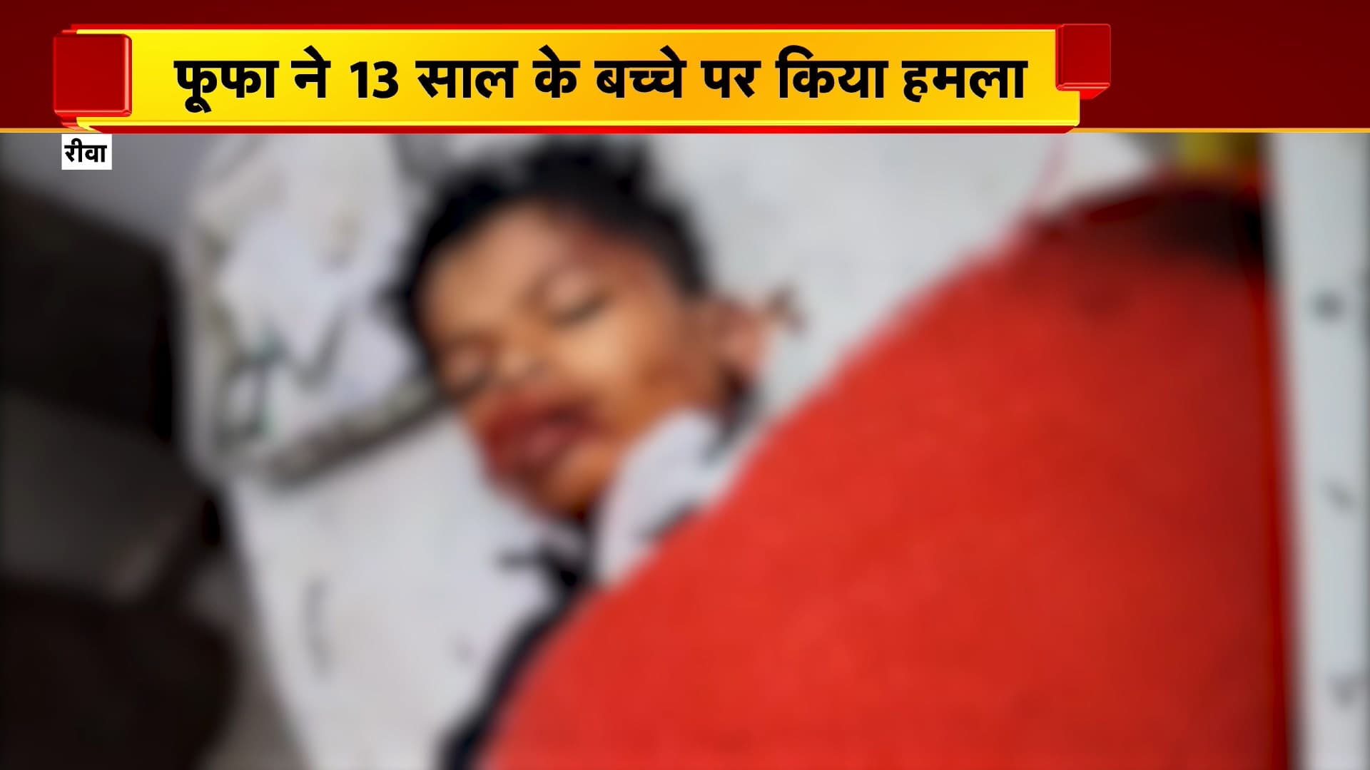 Rewa News : फूफा ने 13 साल के बच्चे पर किया हमला | गोविंदगढ़ थाना क्षेत्र की घटना