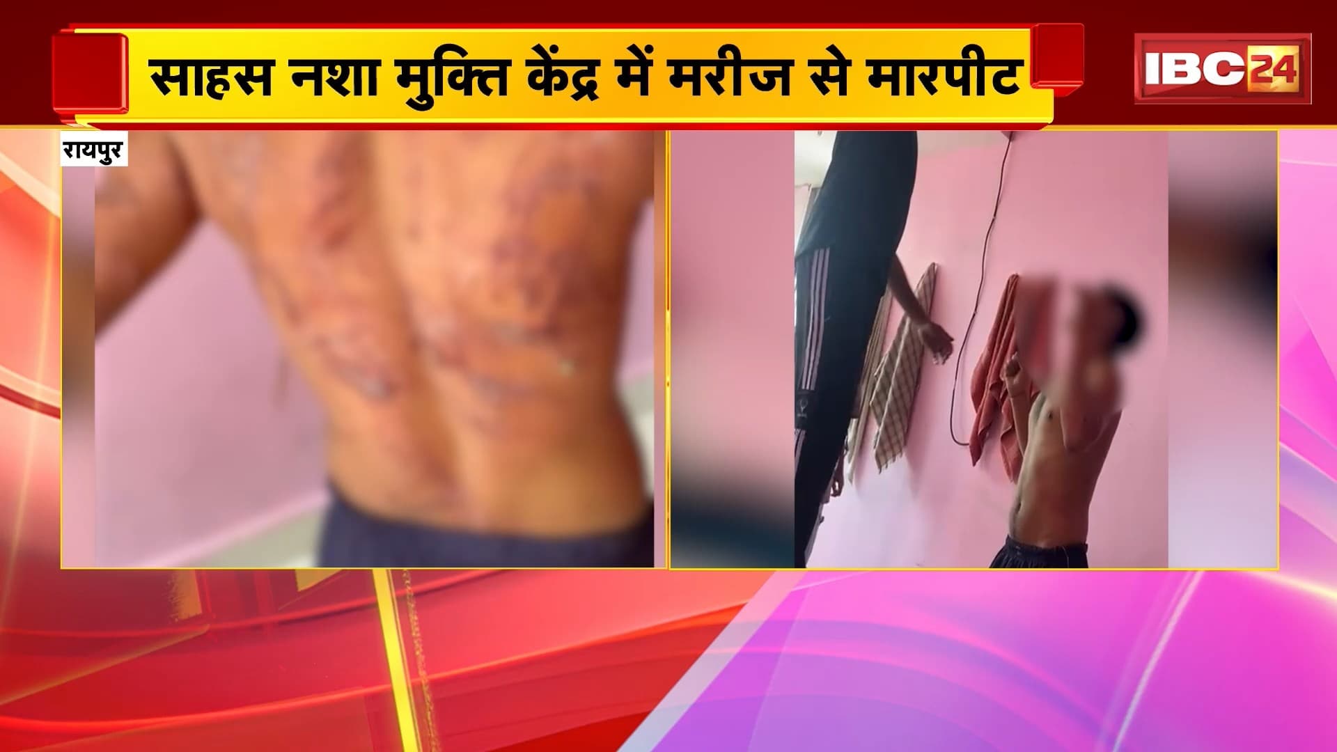 Raipur Crime News: साहस नशा मुक्ति केंद्र में मरीज से मारपीट, पीड़ित युवक के परिजन ने कराई FIR