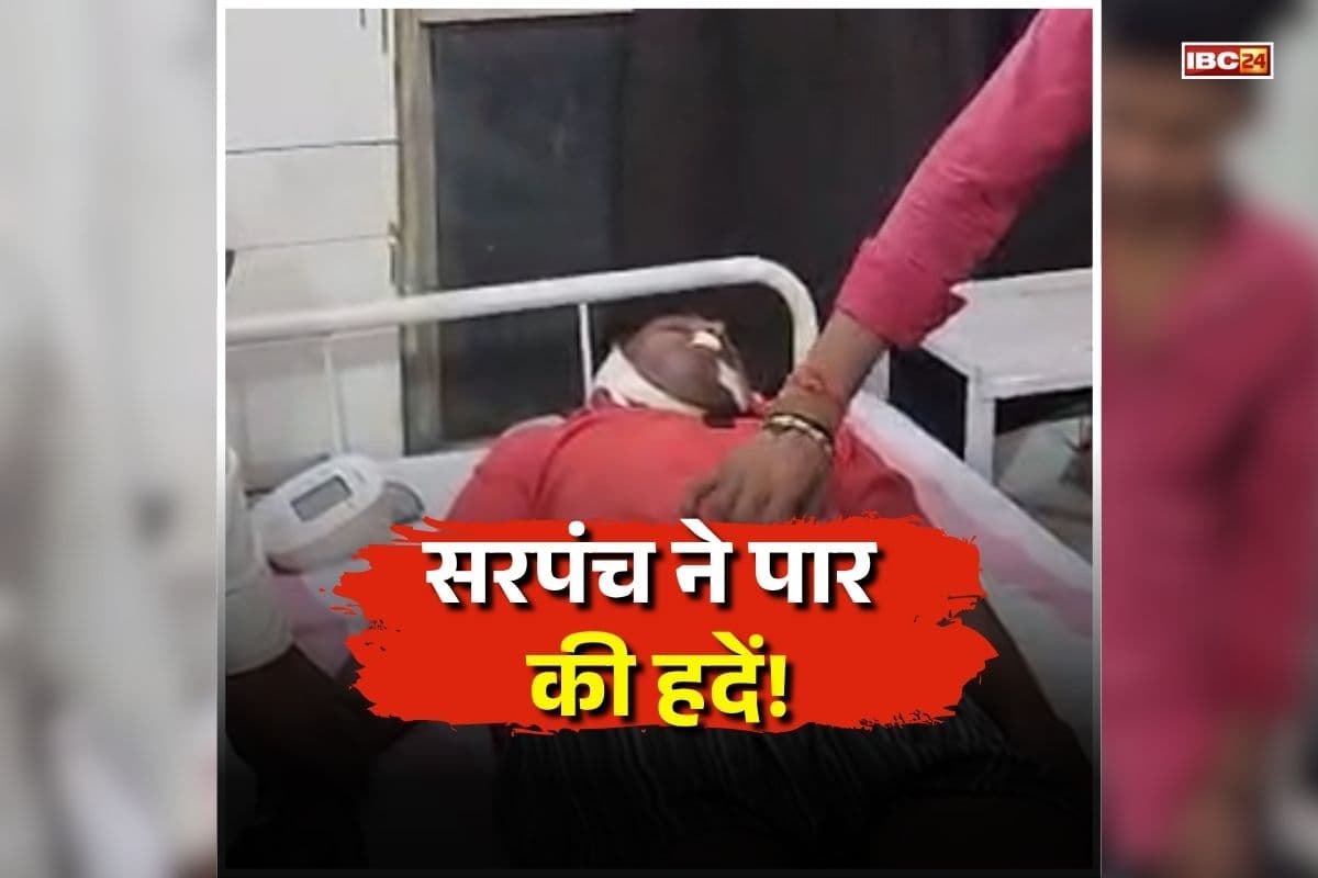 Sheopur Crime News: सरपंच ने पार की हदें! बेटे के साथ मिलकर ग्रामीण का कर दिया ये हाल, अब अस्पताल में लड़ रहा जिंदगी और मौत की जंग