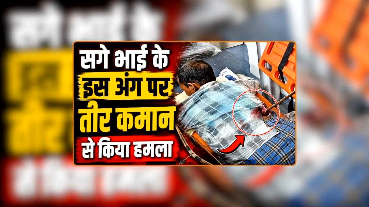 Attack with bow and arrow: सगे भाई पर युवक ने किया तीर कमान से हमला, इस अंग पर जाकर लगा बाण, मामूली बात पर दोनों के बीच हुआ था विवाद