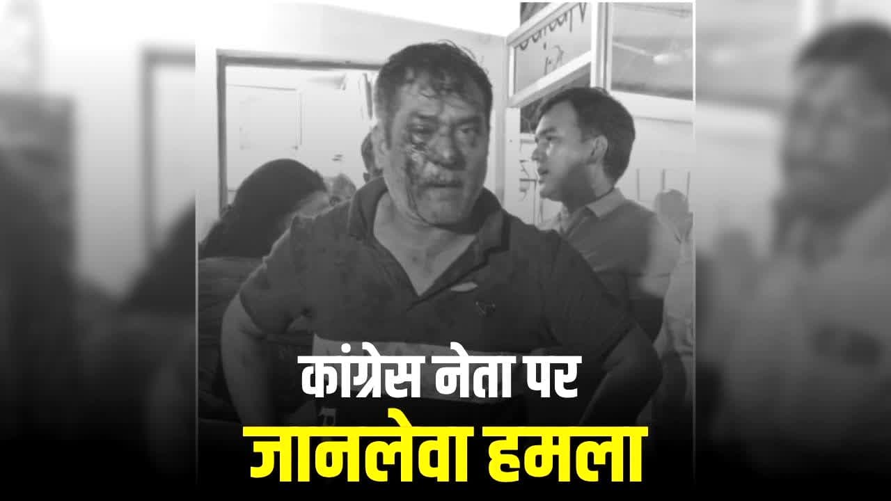 Chhattisgarh Congress Leader Attack: छत्तीसगढ़ में कांग्रेस नेता पर जानलेवा हमला, इस BJP नेता पर हमला करवाने का आरोप, 15 से ज्यादा बदमाश घर में घुसे फिर….पत्नी को भी नहीं छोड़ा
