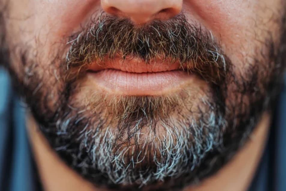 White Beard Treatment and Solution: जवानी में आपकी दाढ़ी भी हो रही है सफ़ेद? तो हो जाये सावधान, फ़ौरन अपनाएं ये उपचार वरना..