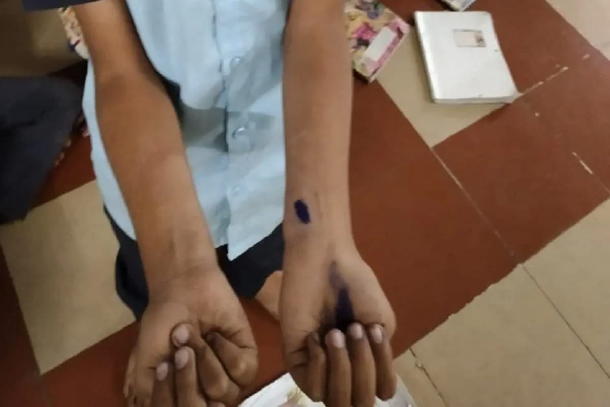 Gujarat News: इस स्कूल के छात्रों ने एक-दूसरे को ब्लेड मारने की दी चुनौती, नहीं करने पर इतने रुपए सजा का किया प्रावधान, 25 से ज्यादा बच्चे घायल