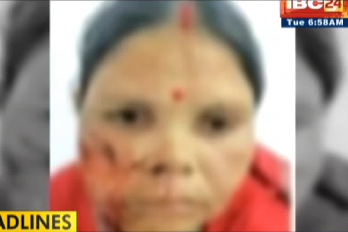 Gwalior Street Dog Attacked : आवारा कुत्ते ने महिला का गाल खाया, पांच साल के बच्चे को भी नोच डाला, टांके लगाने के बाद बोले डॉक्टर