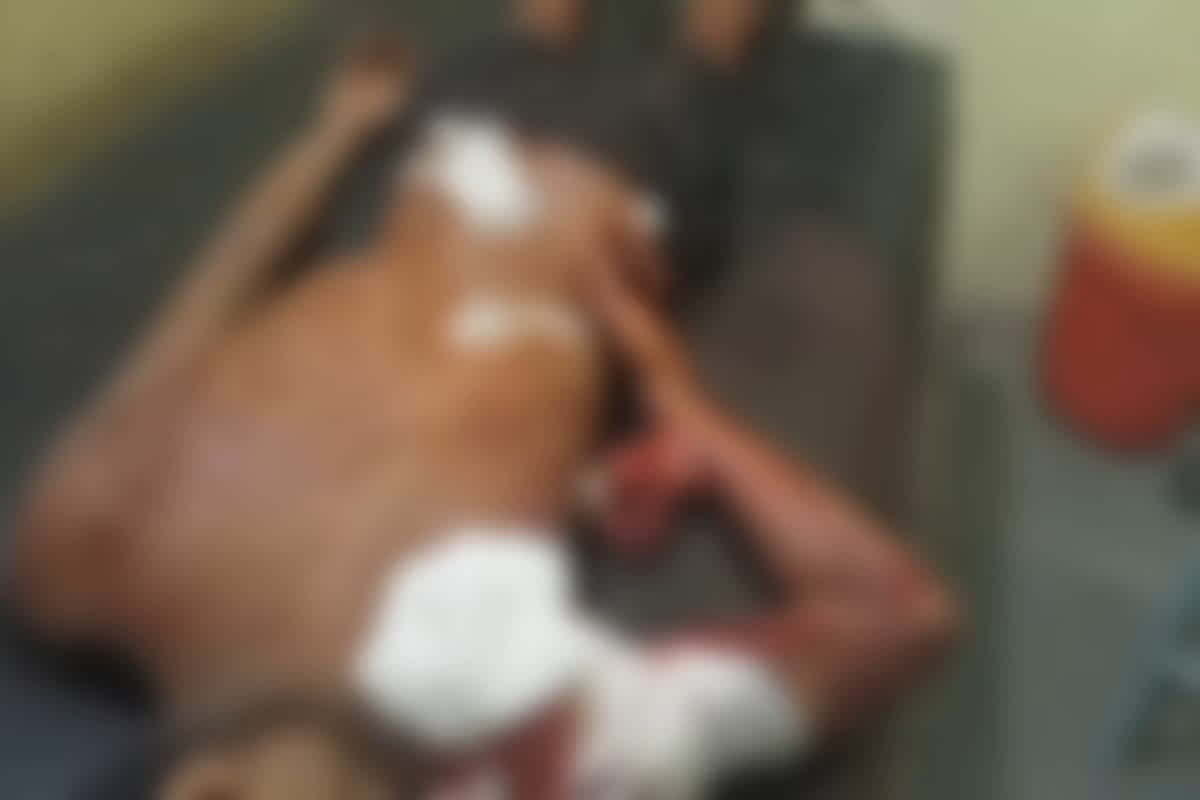 Sakti News: झोला छाप डॉक्टर ने धारदार हथियार से शख्स पर किया जानलेवा, गंभीर रूप से घायल हुआ युवक