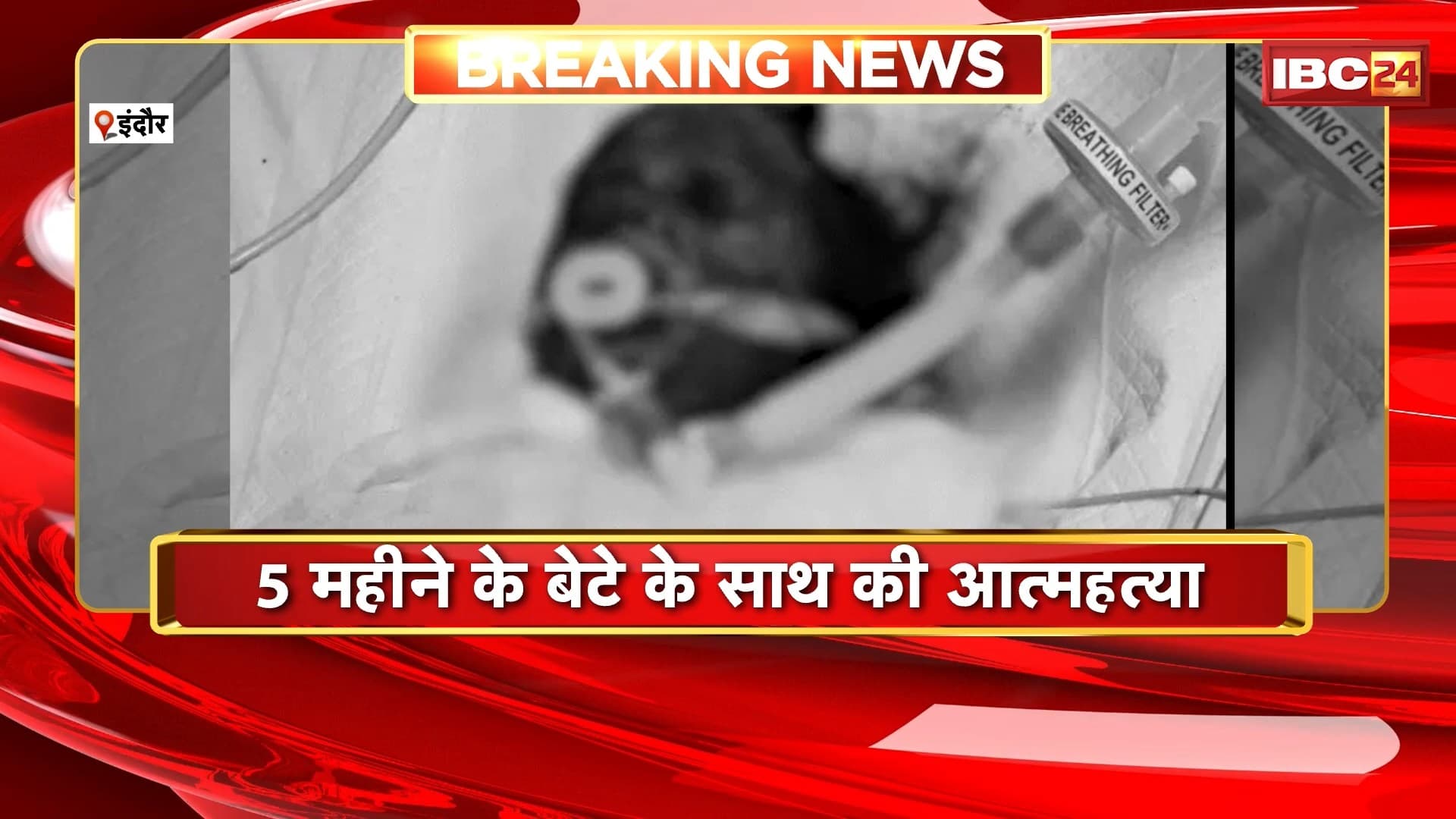 Indore Suicide Case: 5 माह के मासूम के साथ मां ने खुद पर डाला ज्वलनशील पदार्थ। पति पर लगाया प्रताड़ना का आरोप