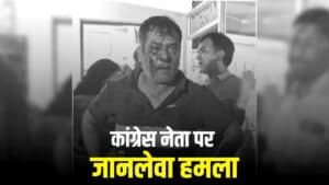 Chhattisgarh Congress Leader Attack: छत्तीसगढ़ में कांग्रेस नेता पर जानलेवा हमला, इस BJP नेता पर हमला करवाने का आरोप, 15 से ज्यादा बदमाश घर में घुसे फिर….पत्नी को भी नहीं छोड़ा