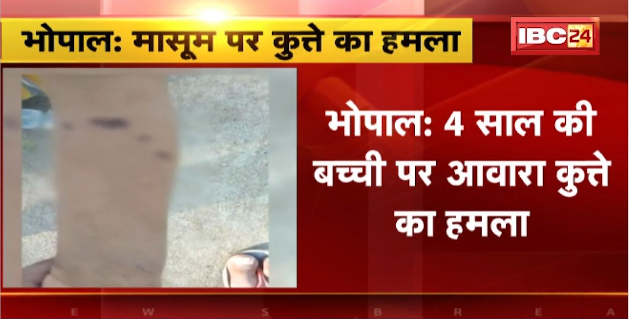 Stray Dogs Attack in Bhopal : 4 साल की बच्ची पर आवारा कुत्ते का हमला। सर्वधर्म कॉलोनी की घटना