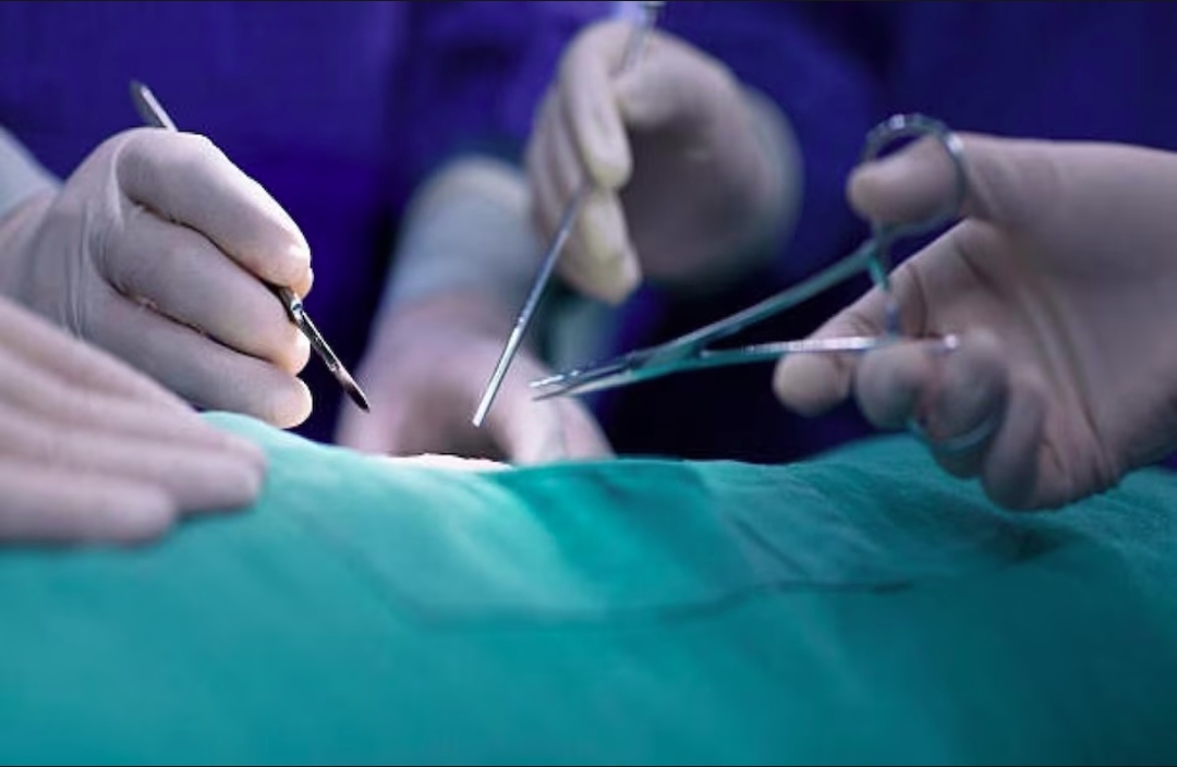 डॉक्टर ने कर दी बड़ी लापरवाही…! बच्चे की जीभ का ऑपरेशन की जगह कर दिया खतना, परिजनों ने किया हंगामा