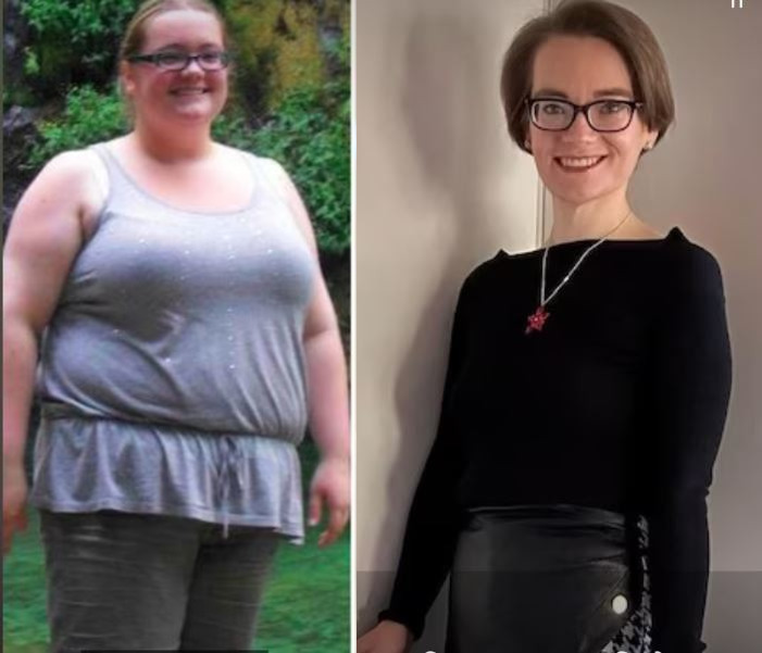 Fat Weight Loss Diet : 141 किलो की लड़की ने बिना एक्सरसाइज घटाया 64 किलो वजन, जानें कैसा था डाइट प्लान