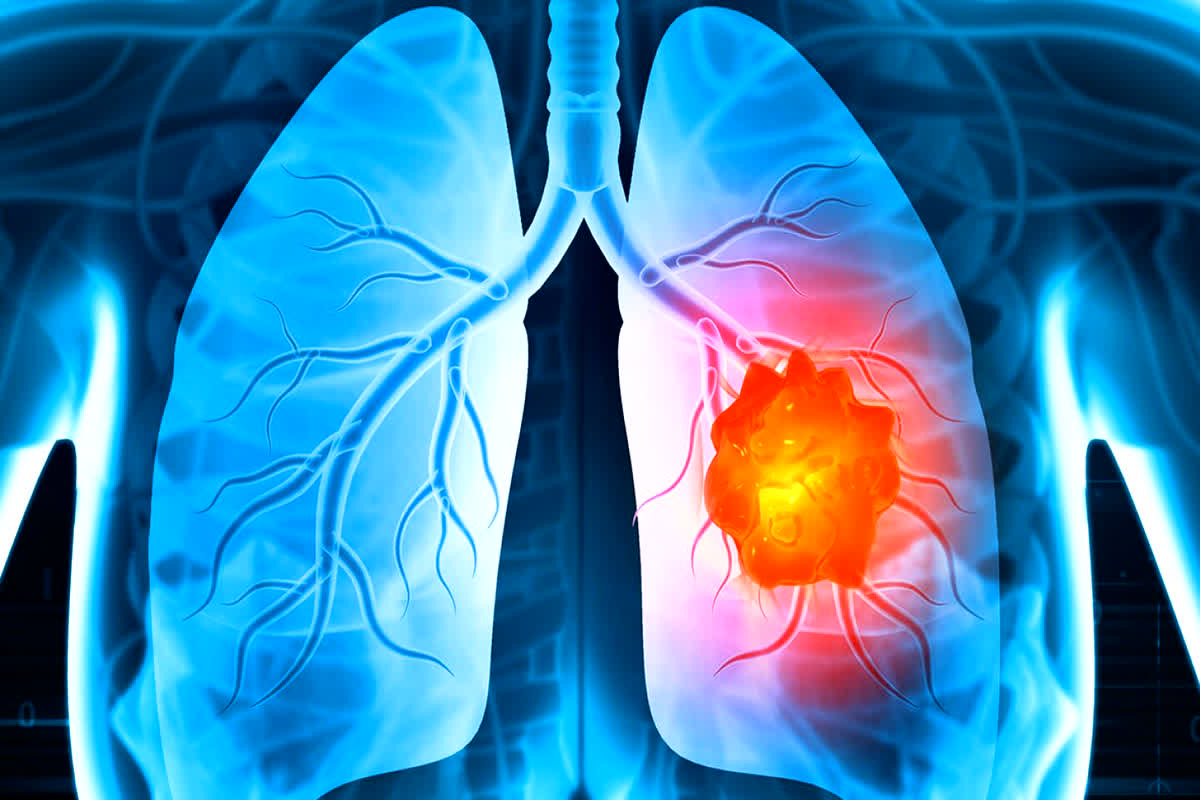 Edited By Bhavna Sahu Modified Date January 23, 2024 / 0226 PM IST