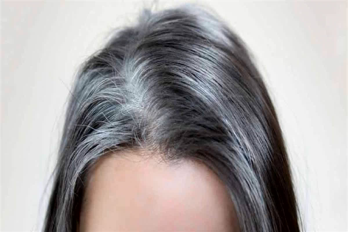 White hair problem: आखिर कम उम्र में क्यों सफेद हो रहे बाल? जानिए इसके पीछे की असल वजह