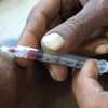 डॉक्टर की लापरवाही : शहर में 900 लोगों को हुआ एचआईवी, कचरे के डब्बे से निकालकर नि​डिल लगाता था इंजेक्शन