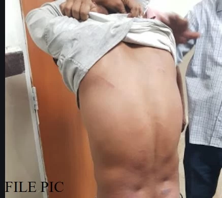 SAF जवान की बांधकर पिटाई, अब 9 डॉक्टरों के खिलाफ दर्ज किया गया मामला